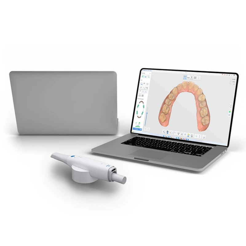 Escáneres dentales