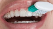 Opalescence PF 10% Kit Paciente (1)